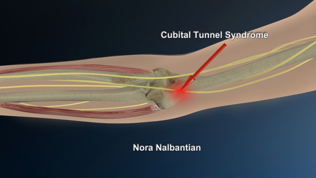 Injury3