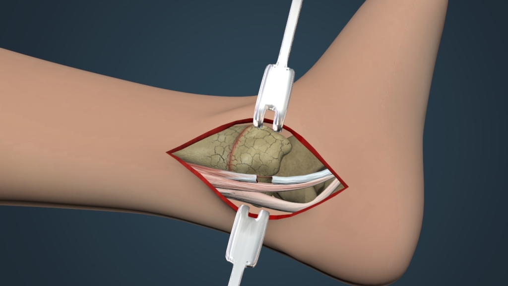 Surgery4