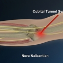 Injury3