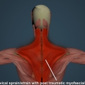 InjuryBack1