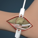 Surgery4